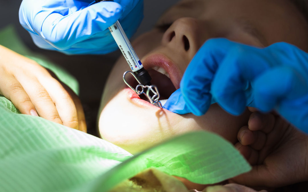 Sedación en tratamiento dentales de los niños